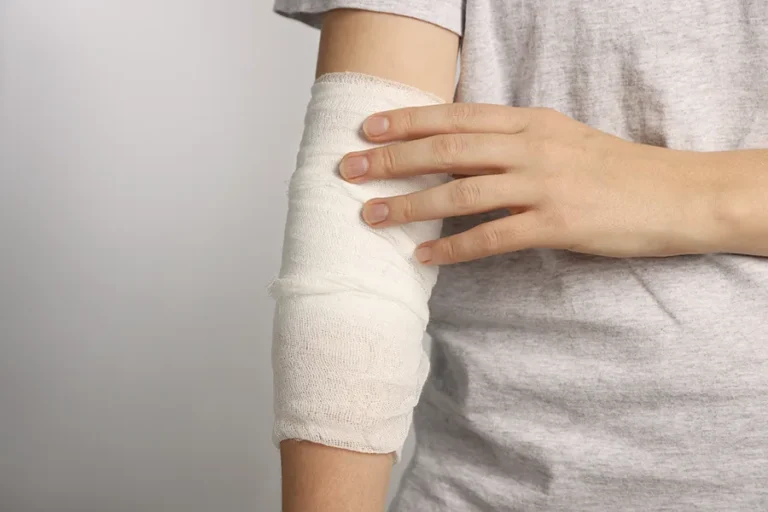 arm-wrapped-in-white-bandage-for-protection